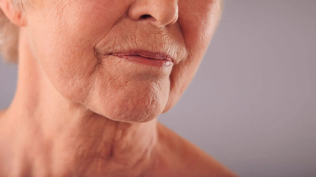 Clínica Trajano – tratamiento de línea de marioneta en Sevilla para rejuvenecimiento facial