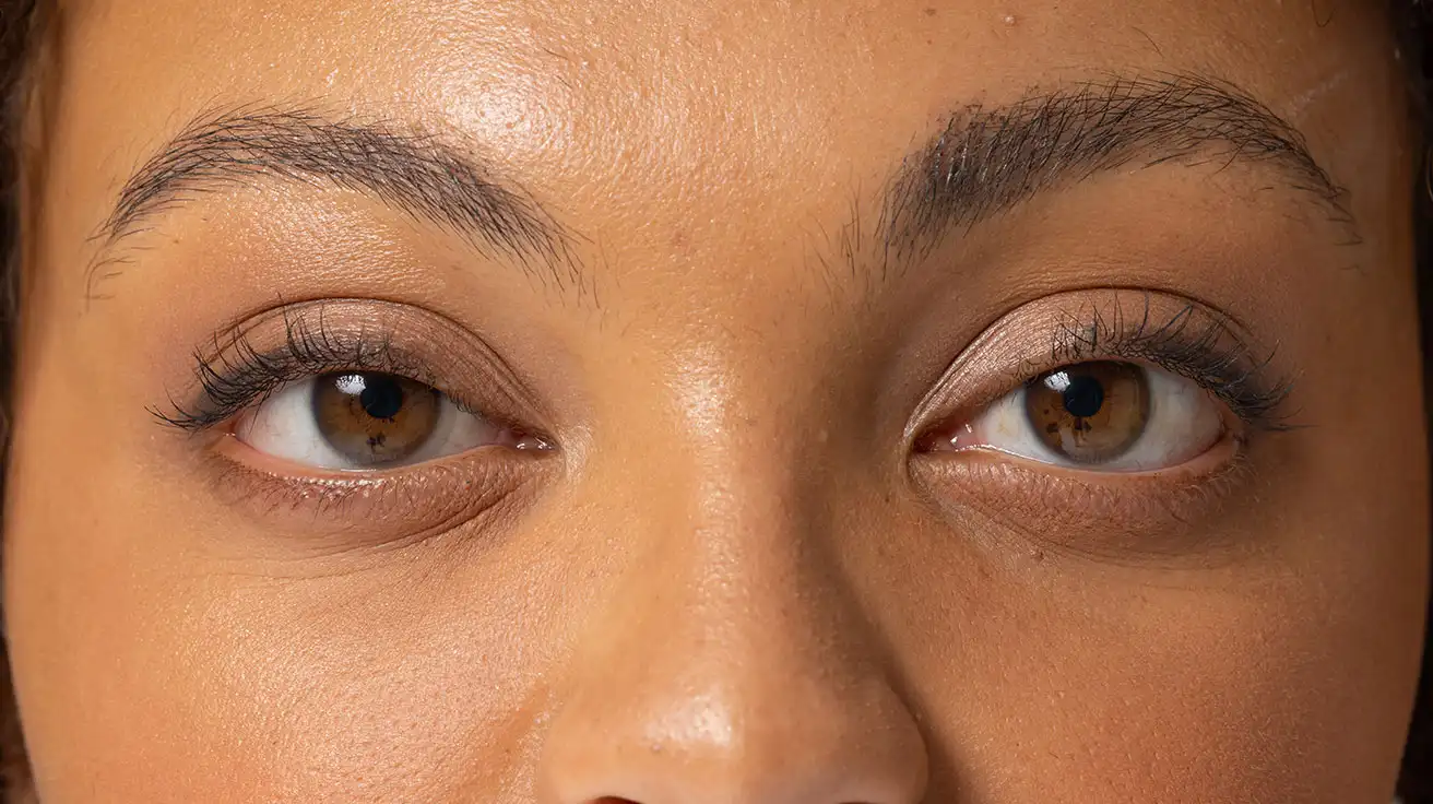 Clínica Trajano – tratamiento de ojeras en Sevilla para rejuvenecer la mirada